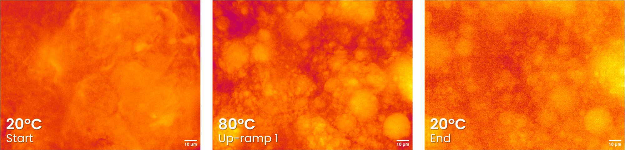 Nile red dye highlights the lipids in the v-slice system